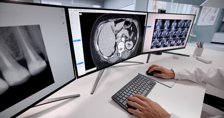 Medical Doctor Examining MRI Scan On Computer Desktop Monitor