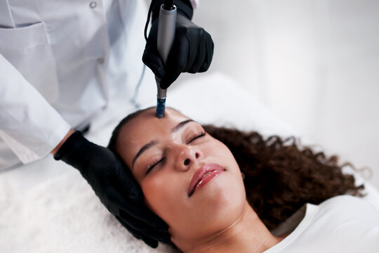 Young Latina Woman Receives Microneedling Treatment From Expert Dermatologist