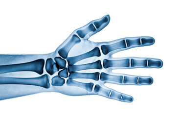 Hand skeleton x-ray isolated on transparent background