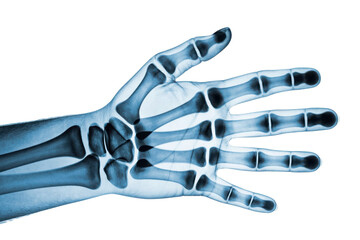 Hand skeleton x-ray isolated on transparent background