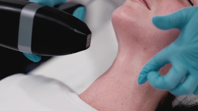 Woman receiving microneedle RF treatment on the jawline and neck for skin rejuvenation and tightening in a medical clinic. Concept aesthetic medicine, advanced anti-aging