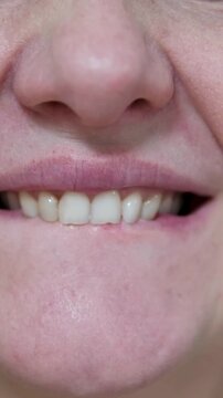 Woman bites her lips. Nervous tic. Obsessive-compulsive disorders. Patient of a psychiatric clinic biting lips, scratch face, biting nails, eye twitching. Close up, macro. 