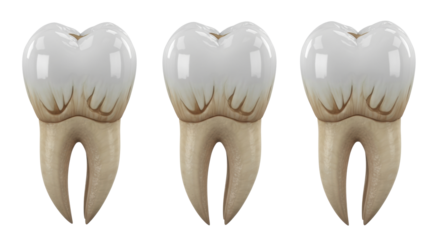 highly realistic 3d render of a three-rooted human maxillary first molar tooth, showing intricate crown cusps in four segmented anatomical views on transparent. concept for academic dentistry