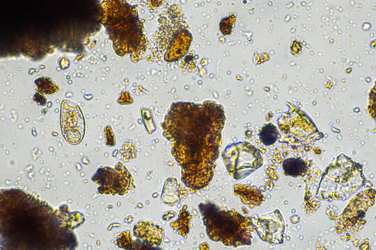 Soil under the microscopy, looking at sand, silt and clay and soil biology, amoebae, fungi, fungal, microbes and nematodes in a cattle farm in australia.
