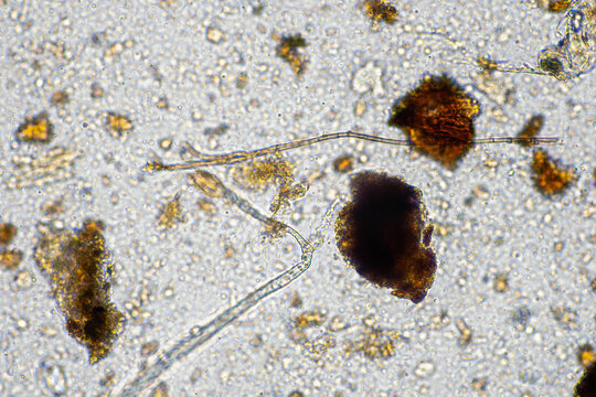 Soil under the microscopy, looking at sand, silt and clay and soil biology, amoebae, fungi, fungal, microbes and nematodes in a cattle farm in australia.