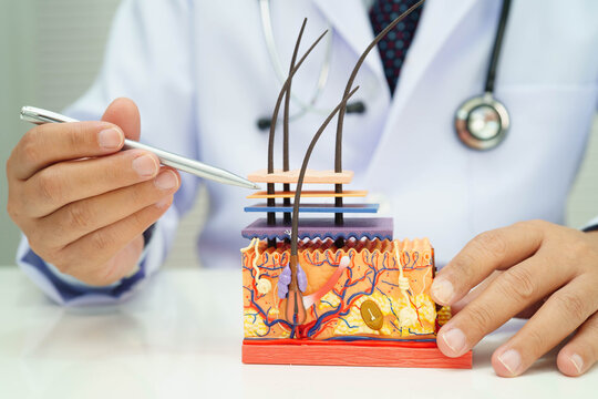 Hair transplant, Asian dermatologist doctor holding skin structure anatomy model for treatment in hospital.