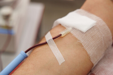blood donation self capture of arm