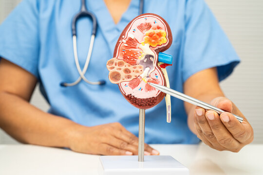 Chronic kidney disease, doctor with model for treatment urinary system, urology, Estimated glomerular filtration rate eGFR.