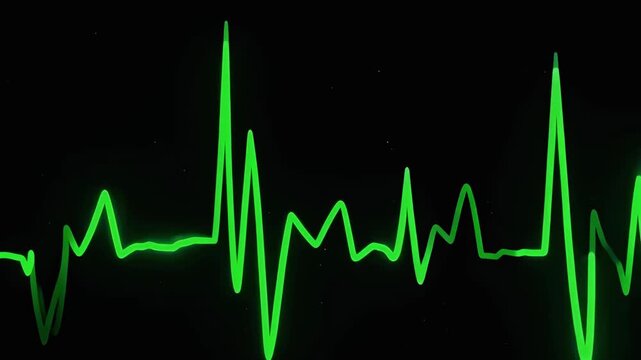 Neon green ECG waveform accelerates and becomes highly erratic, illustrating dramatic medical vital signs changes on a black screen.