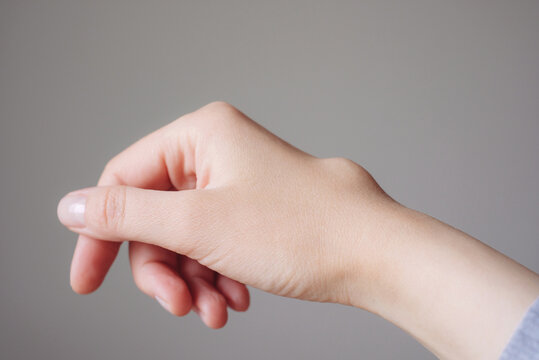Female right back hand with ganglion cyst on the dorsum,  fluid-filled bump associated with a joint or tendon sheath, close-up view, selected focus.