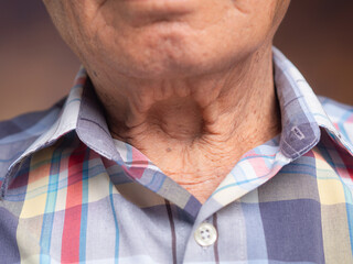 Senior man neck skin with aging health concept.