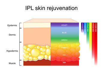 IPL skin rejuvenation. Intense Pulsed Light for skin photorejuvenation. Anti-aging therapy