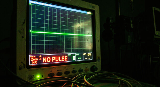 Hospital Monitor Screen Displaying Flatline and No Pulse