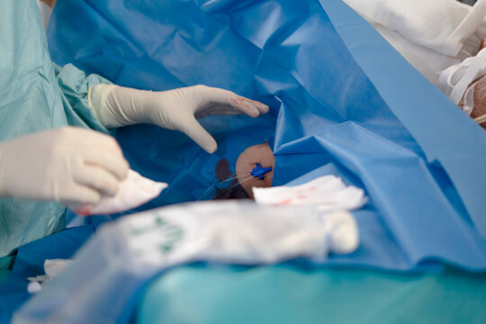 Female doctor performing central line insertion