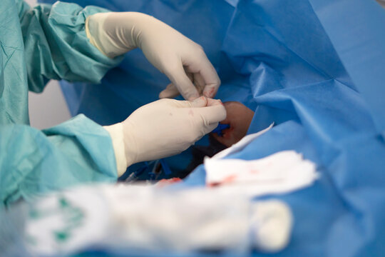 Female doctor inserting central line in hospital setting