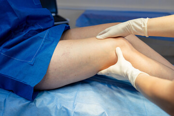 Vascular leg examination as a doctor visually inspects and palpates.