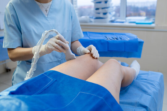 Ultrasound imaging for leg vein assessment by doctor.