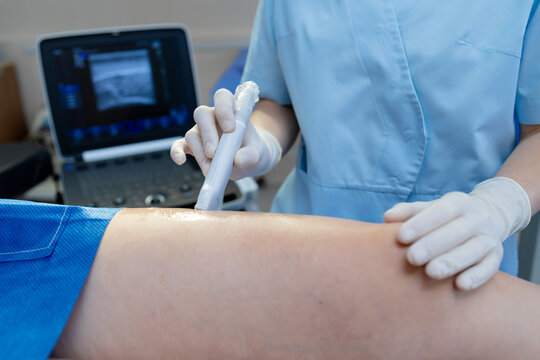 Doctor performing detailed ultrasound examination of leg veins.