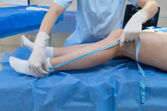 Doctor measuring leg girth and length for vascular evaluation.
