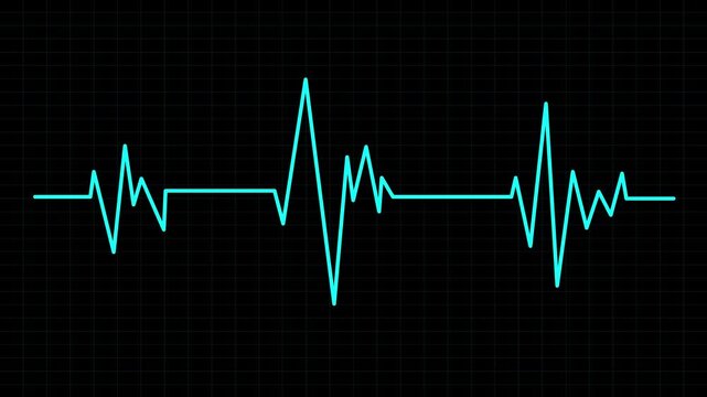 Cardiograph recording heart rate monitor line on a black grid, suitable for medical, healthcare, technology, fitness, and wellness concepts. Keeps track.