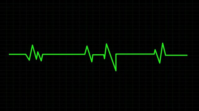 Cardiograph recording on a black grid. Perfect for medical presentations, health articles, and digital design projects.