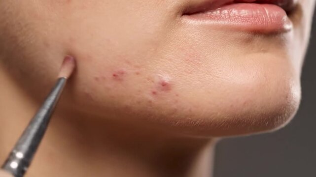 Closeup of acne and skin texture with a makeup brush