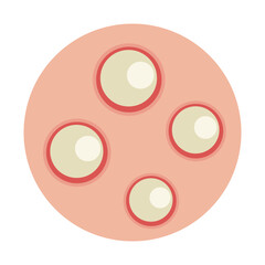 Fototapeta premium monkey pox, Mpox disease skin symptom concept