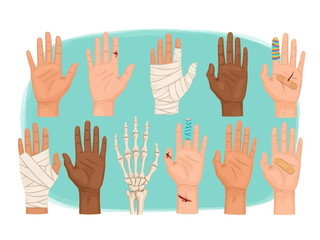 Obraz premium Diverse hands with various injuries and bandages on a blue background