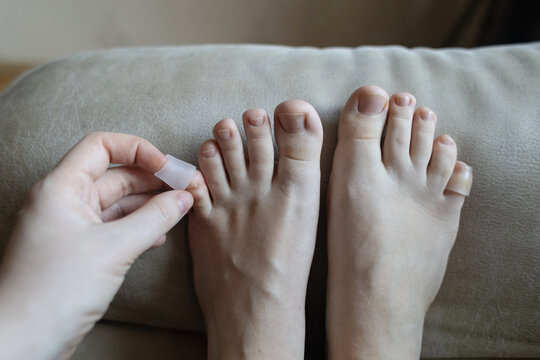 Silicone toe sleeve or cap. Woman puts on protective cover on little toe. Fights corns, prevents blisters and ingrown toenails