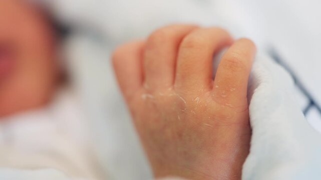 Close-up of a newborn baby's hand showing dry, peeling skin a common condition in the first few days of life. The image highlights the delicate nature of baby skin and the need for gentle care.
