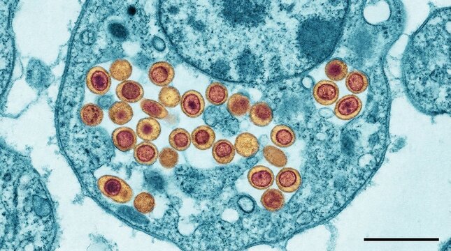 Microscopic View of Monkeypox Virus Particles Inside Human Cell
