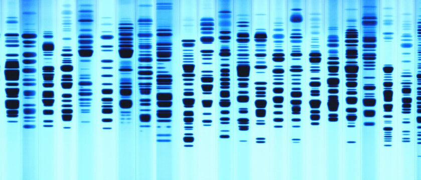 Abstract DNA gel electrophoresis analysis showing genetic bands in blue, ideal for science, genetics, and medical research concepts.