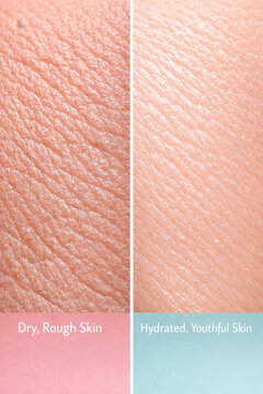 Skin aging vs after collagen boost dry rough skin closeup texture detail and hydrated youthful skin texture detail skincare result comparison concept healthy glow beauty care