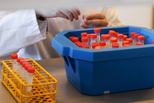 test tubes in a chemical lab with the hands of a chemist working in the background.