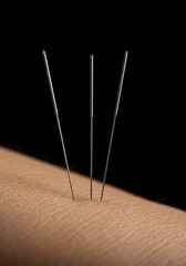 Fine therapeutic needles carefully inserted into skin during traditional Eastern medicine treatment, promoting relaxation and natural healing processes ,point ,insertion ,energy