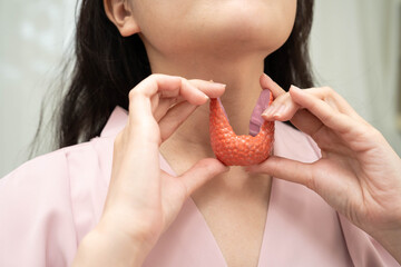 Hyperthyroidism, Overactive Thyroid, Thyroid Lymphoma, Asian woman with thyroid gland human anatomy model.