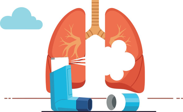 Illustration depicting an asthma inhaler being used to deliver medication directly into the lungs for immediate respiratory relief during an attack