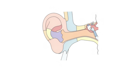 Minimalist colorblock layout image displaying a side profile ear silhouette divided into sections illustrating differences between outer and middle ear conditions.