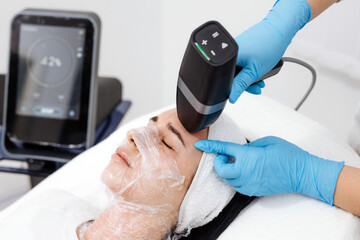 Female patient receiving microneedle RF lifting on the face in a beauty clinic, technician using a handheld device, advanced equipment in the background. Concept microneedle RF, facial lifting, cosmet © wedmoments.stock