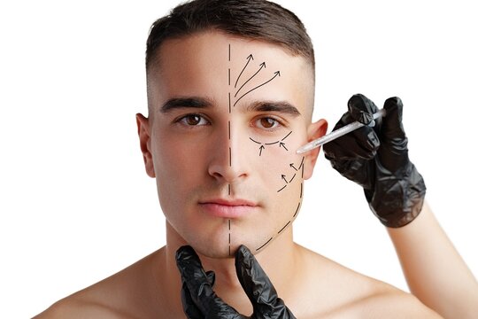 Man receiving facial marking for cosmetic procedure in a clinical setting