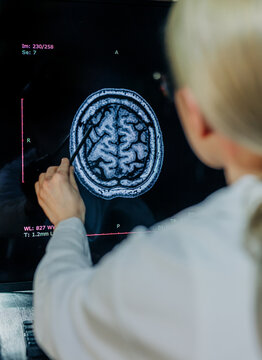 Doctor analyzing brain MRI image for disease diagnosis