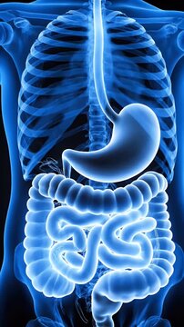 A medical illustration showing the human digestive system, highlighting the stomach and intestines.