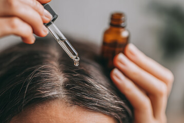 A close-up of hands applying hair oil with a dropper onto a scalp showing the precision and care in hair treatment against a blurred background emphasizing the focus on self-care routines