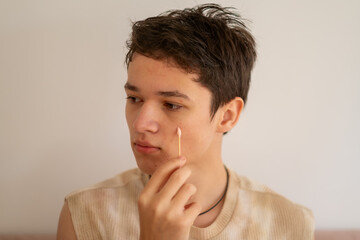 Fototapeta premium A young man applies a special product to a pimple with a cotton swab, a teenager's daily skin care routine for problematic young skin concept