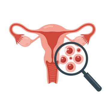 Female reproductive system anatomy with magnified view of ovaries and ova illustration on white background
