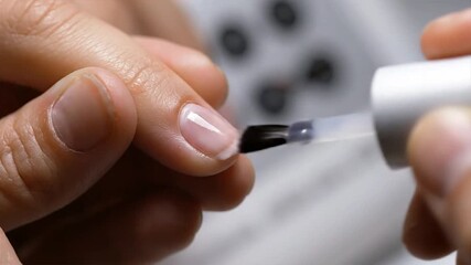 Dermatology specialist conducting nail examination on patient's fingernail with specialized tool in a clinical setting