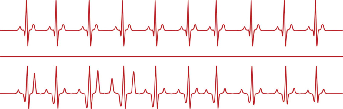 Electrocardiogram heartbeat line illustration showing heart rate monitoring, pulse rhythm and medical health signal vector design