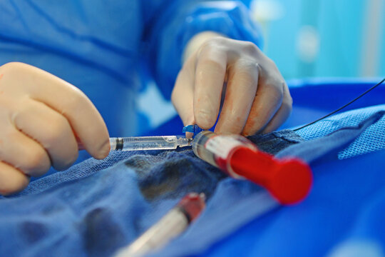 Operations on veins to remove blood clots. Prevention of blood clots. Endovascular surgery.Surgical interventions on blood vessels.