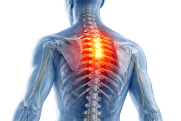 Human upper back and thoracic spine anatomy showing inflamed vertebrae nerves causing severe back pain isolated on white background