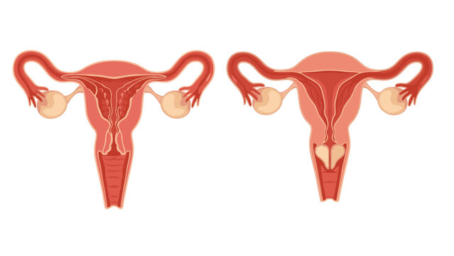 Medical illustration shows views of the human female reproductive system including the uterus ovaries and fallopian tubes on white.